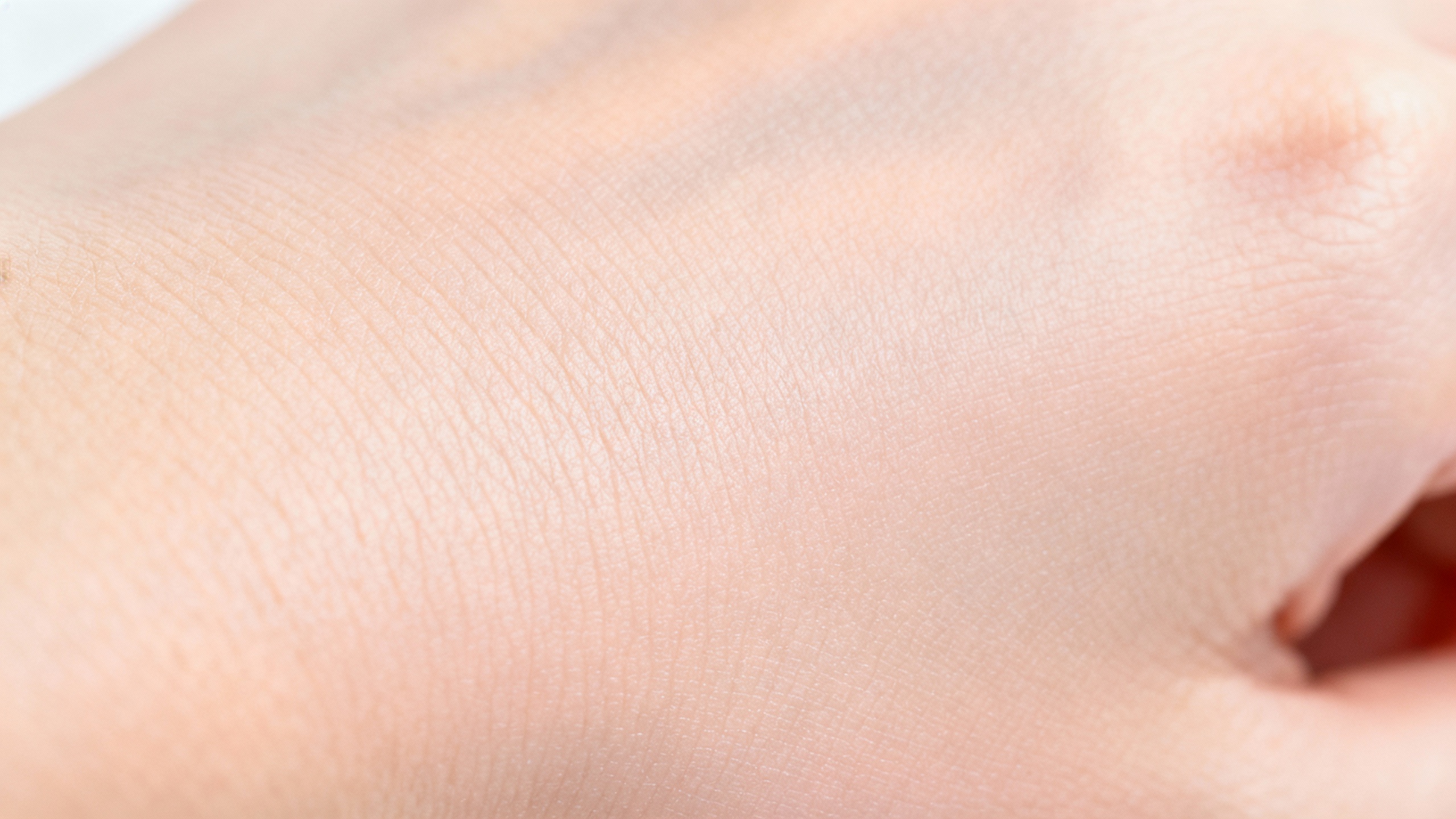 Featured image for How long does it take for acne scars to fade?